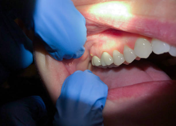 Best Chipped Tooth Repair Near Me  in Despard, WV